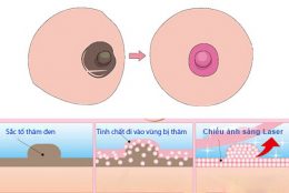 Liệu trình thay da sinh học kết hợp laser và tinh chất peel da